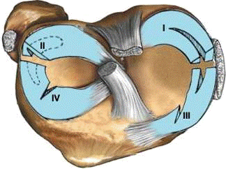 Глава какие бывают разрывы менисков коленного сустава  1